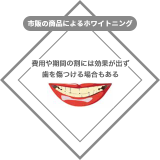 市販の商品によるホワイトニング:費用や期間の割には効果が出ず、歯を傷つける場合もある