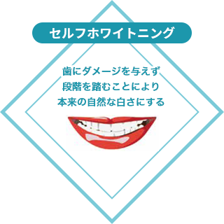 セルフホワイトニング:歯にダメージを与えず段階を踏むことにより本来の自然な白さにする