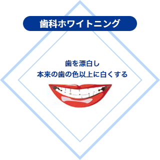 歯科ホワイトニング:歯を漂白し、本来の歯の色以上に白くする